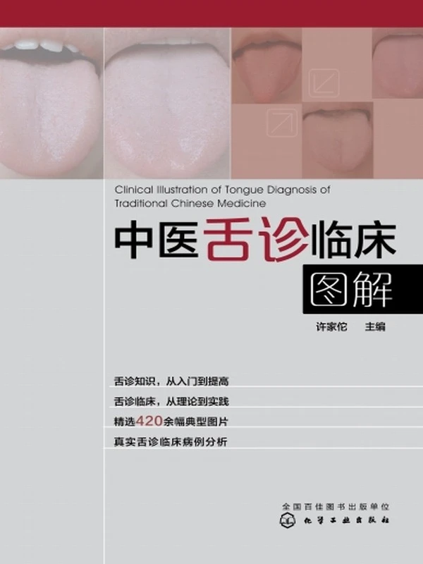 中医舌诊临床图解 (许家佗)插图