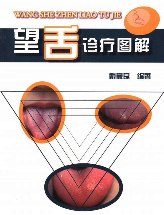 望舌诊疗图解